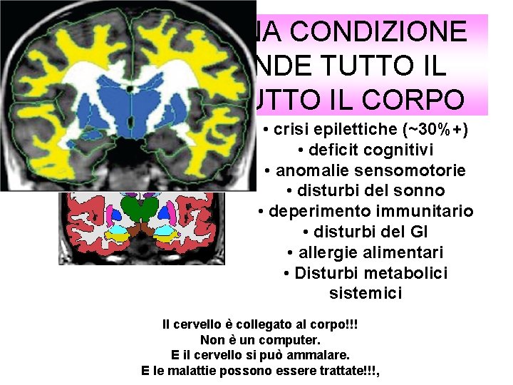 L’AUTISMO è UNA CONDIZIONE CHE COMPRENDE TUTTO IL CERVELLO E TUTTO IL CORPO •