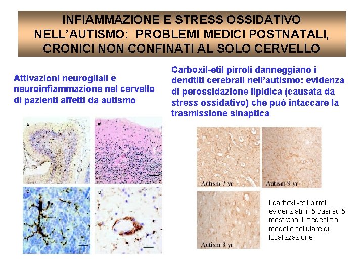 INFIAMMAZIONE E STRESS OSSIDATIVO NELL’AUTISMO: PROBLEMI MEDICI POSTNATALI, CRONICI NON CONFINATI AL SOLO CERVELLO