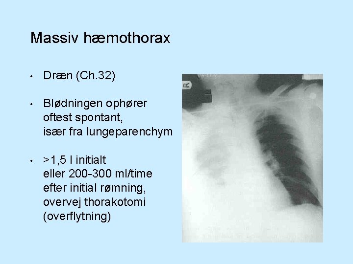 Massiv hæmothorax • Dræn (Ch. 32) • Blødningen ophører oftest spontant, især fra lungeparenchym