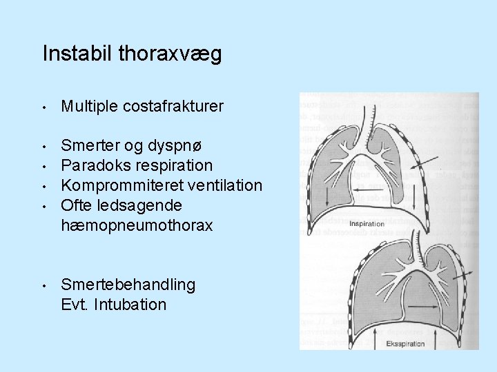 Instabil thoraxvæg • Multiple costafrakturer • Smerter og dyspnø Paradoks respiration Komprommiteret ventilation Ofte