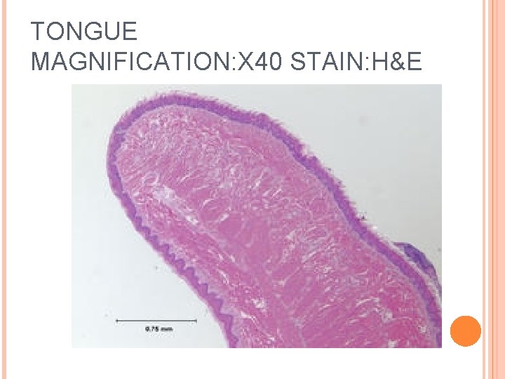 TONGUE MAGNIFICATION: X 40 STAIN: H&E 