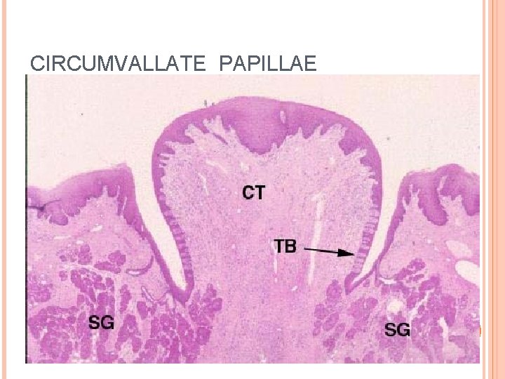 CIRCUMVALLATE PAPILLAE 