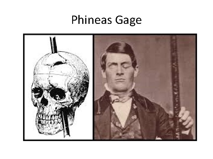 Phineas Gage 