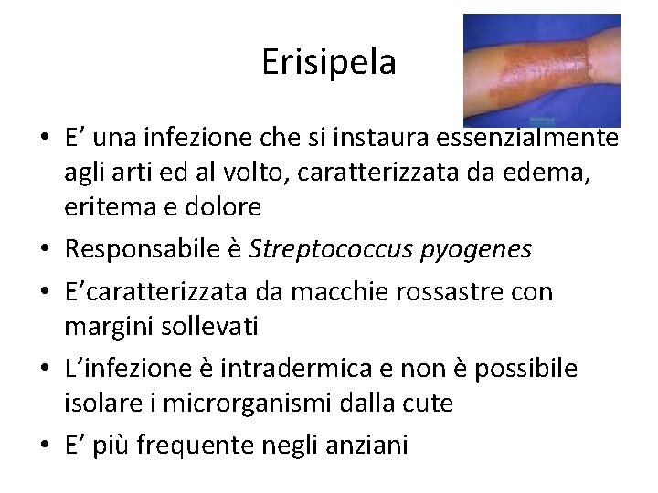 Erisipela • E’ una infezione che si instaura essenzialmente agli arti ed al volto,