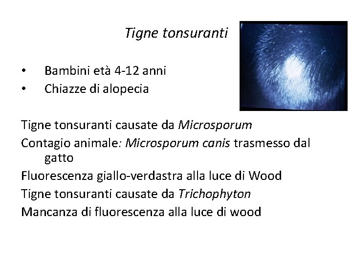 Tigne tonsuranti • • Bambini età 4 -12 anni Chiazze di alopecia Tigne tonsuranti