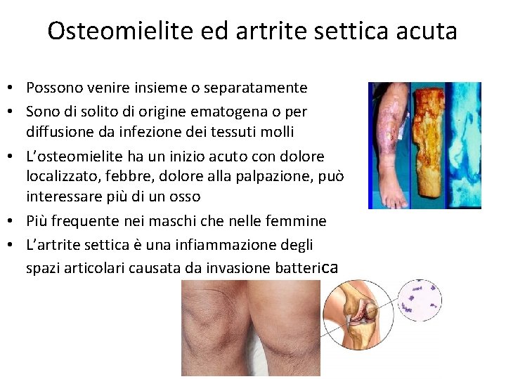 Osteomielite ed artrite settica acuta • Possono venire insieme o separatamente • Sono di