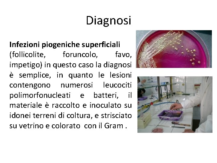 Diagnosi Infezioni piogeniche superficiali (follicolite, foruncolo, favo, impetigo) in questo caso la diagnosi è