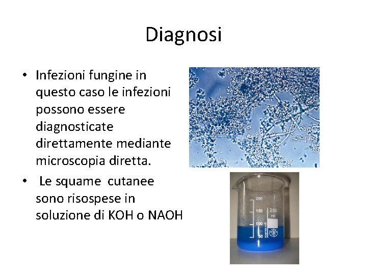 Diagnosi • Infezioni fungine in questo caso le infezioni possono essere diagnosticate direttamente mediante