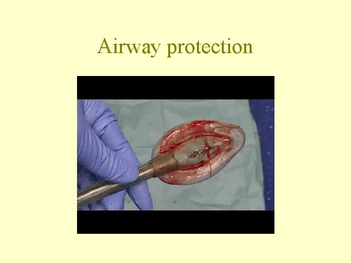 Airway protection 