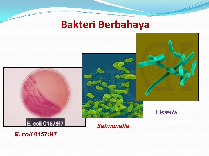 Bakteri Berbahaya Listeria Salmonella E. coli 0157: H 7 