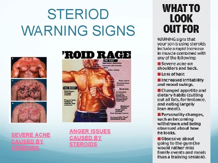 You Can Thank Us Later - 3 Reasons To Stop Thinking About steroide prise de muscle