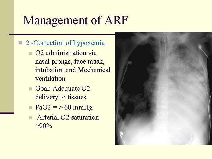 Management of ARF n 2 -Correction of hypoxemia n n O 2 administration via Management of ARF n 2 -Correction of hypoxemia n n O 2 administration via