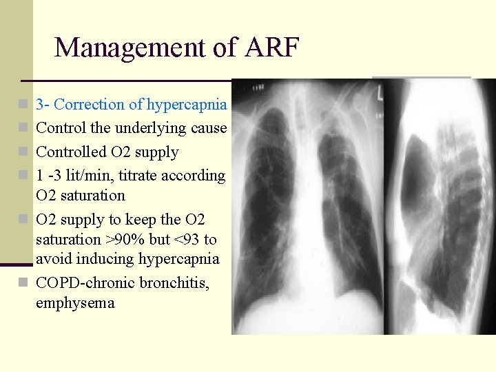 Management of ARF n 3 - Correction of hypercapnia n Control the underlying cause