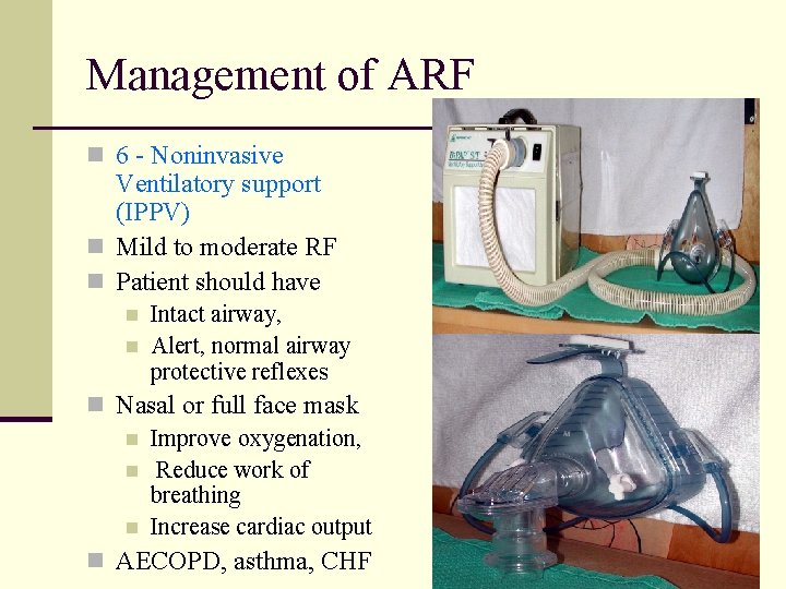 Management of ARF n 6 - Noninvasive Ventilatory support (IPPV) n Mild to moderate