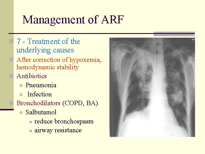 Management of ARF n 7 - Treatment of the underlying causes n After correction