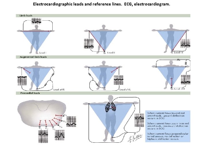 Electrocardiographic leads and reference lines. ECG, electrocardiogram. 
