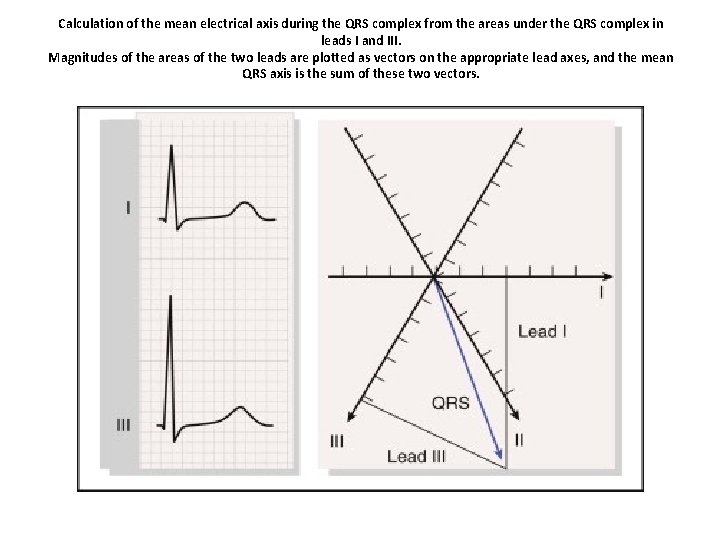 Calculation of the mean electrical axis during the QRS complex from the areas under