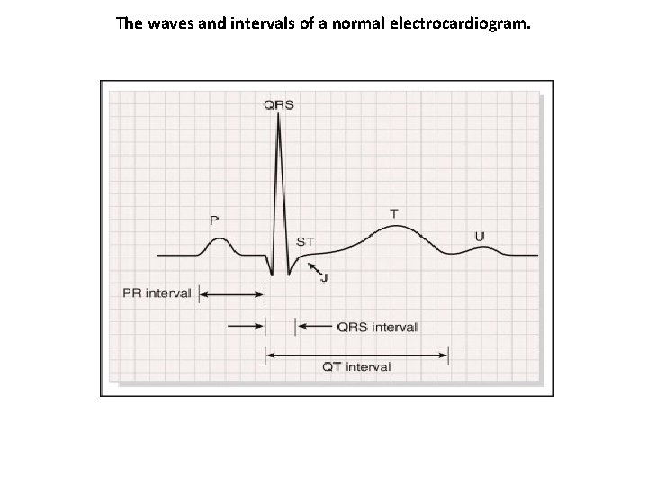 The waves and intervals of a normal electrocardiogram. 