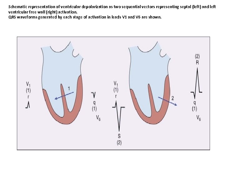 Schematic representation of ventricular depolarization as two sequential vectors representing septal (left) and left