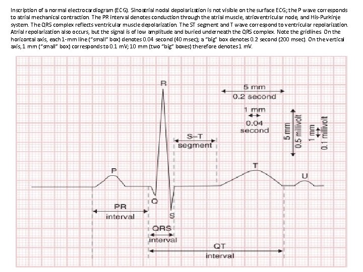 Inscription of a normal electrocardiogram (ECG). Sinoatrial nodal depolarization is not visible on the