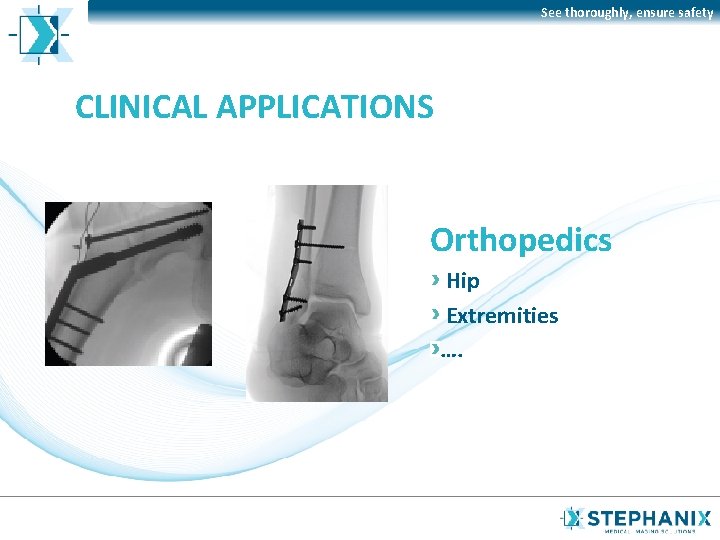 See thoroughly, ensure safety CLINICAL APPLICATIONS Orthopedics Hip Extremities …. 