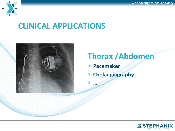 See thoroughly, ensure safety CLINICAL APPLICATIONS Thorax /Abdomen Pacemaker Cholangiography … 