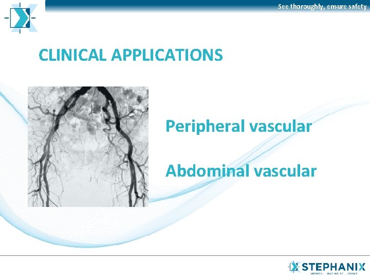 See thoroughly, ensure safety CLINICAL APPLICATIONS Peripheral vascular Abdominal vascular 