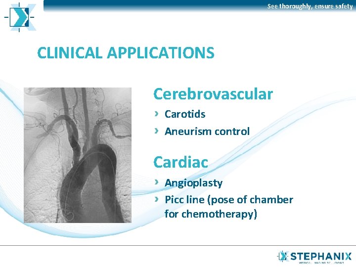 See thoroughly, ensure safety CLINICAL APPLICATIONS Cerebrovascular Carotids Aneurism control Cardiac Angioplasty Picc line