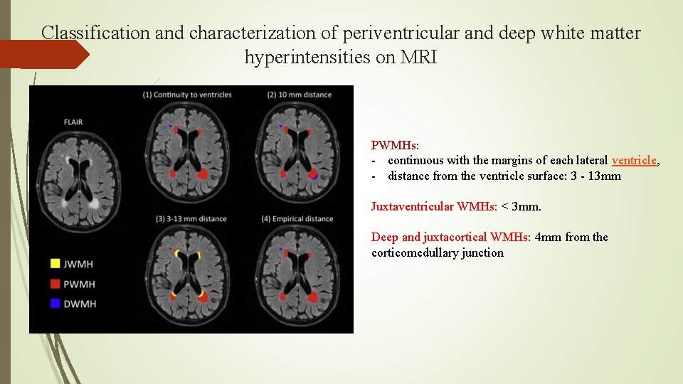 Classification and characterization of periventricular and deep white matter hyperintensities on MRI PWMHs: -