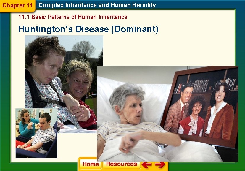 Chapter 11 Complex Inheritance and Human Heredity 11. 1 Basic Patterns of Human Inheritance