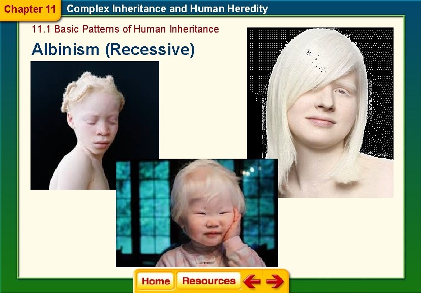 Chapter 11 Complex Inheritance and Human Heredity 11. 1 Basic Patterns of Human Inheritance