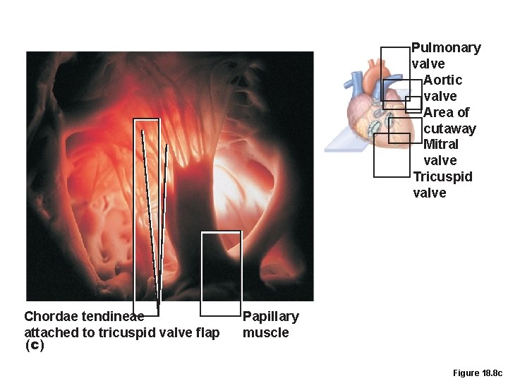 Pulmonary valve Aortic valve Area of cutaway Mitral valve Tricuspid valve Chordae tendineae attached