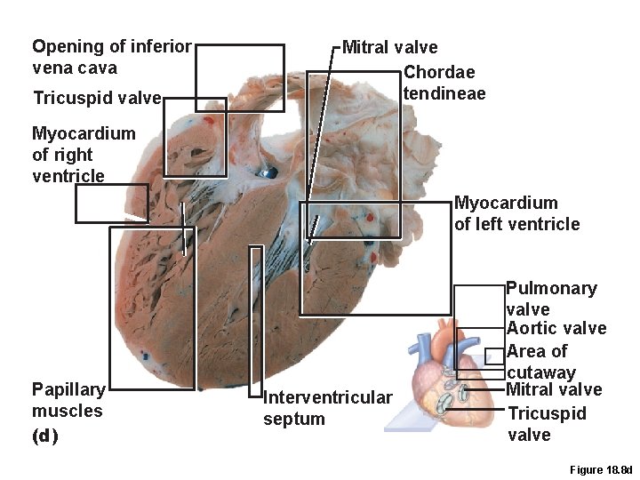 Opening of inferior vena cava Tricuspid valve Mitral valve Chordae tendineae Myocardium of right