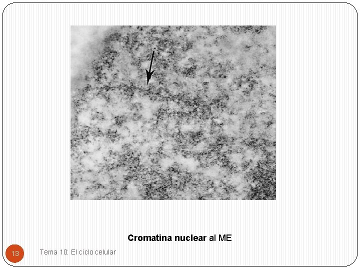 Cromatina nuclear al ME 13 Tema 10: El ciclo celular 