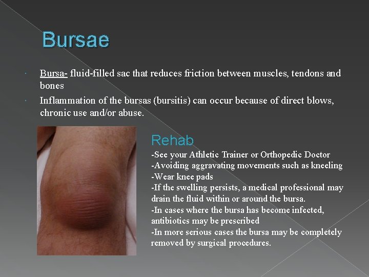 Bursae Bursa- fluid-filled sac that reduces friction between muscles, tendons and bones Inflammation of