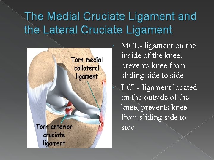 The Medial Cruciate Ligament and the Lateral Cruciate Ligament MCL- ligament on the inside