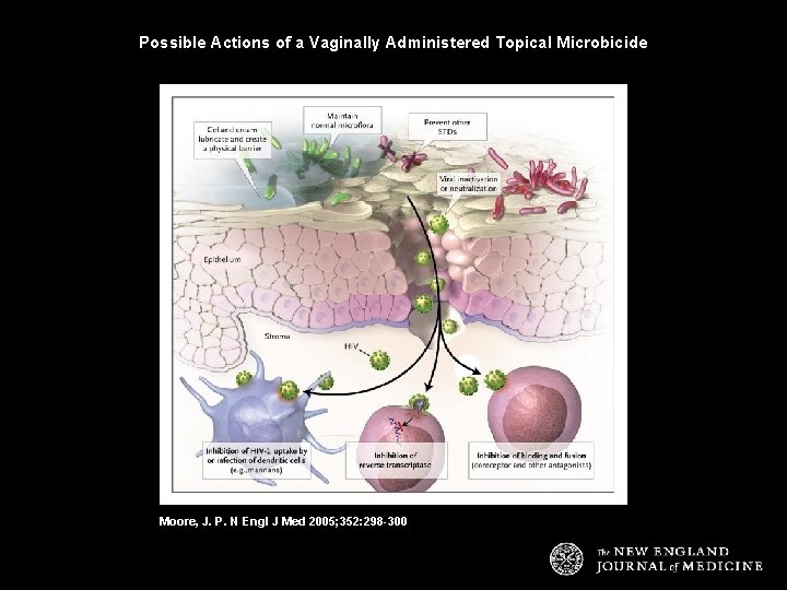 Possible Actions of a Vaginally Administered Topical Microbicide Moore, J. P. N Engl J