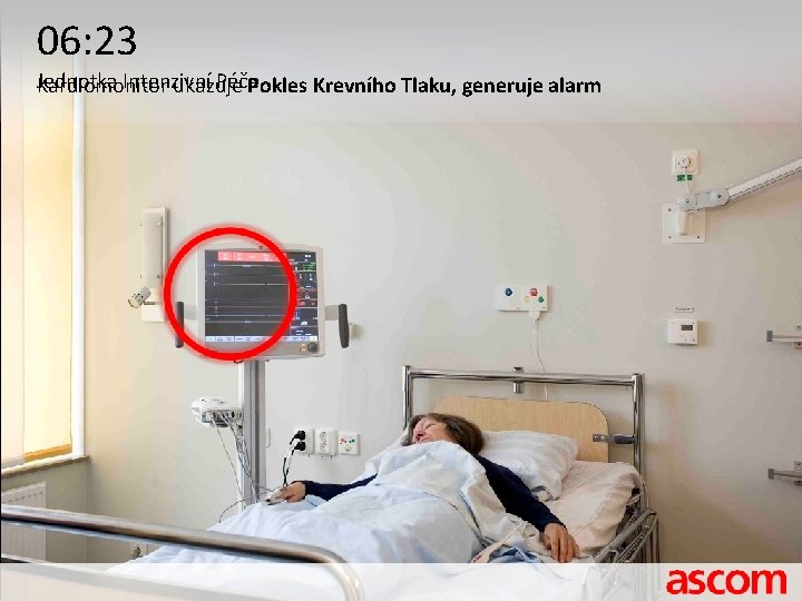 06: 23 Jednotka Intenzivní Péče Kardiomonitor ukazuje Pokles Krevního Tlaku, generuje alarm 