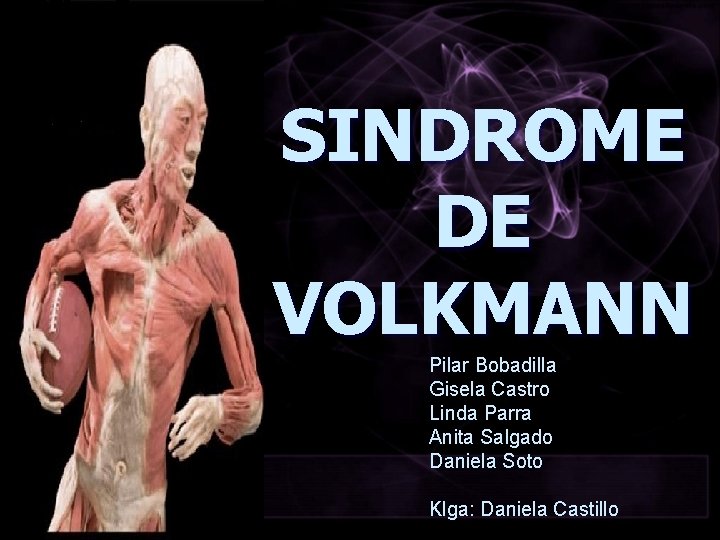 SINDROME DE VOLKMANN Pilar Bobadilla Gisela Castro Linda Parra Anita Salgado Daniela Soto Klga: