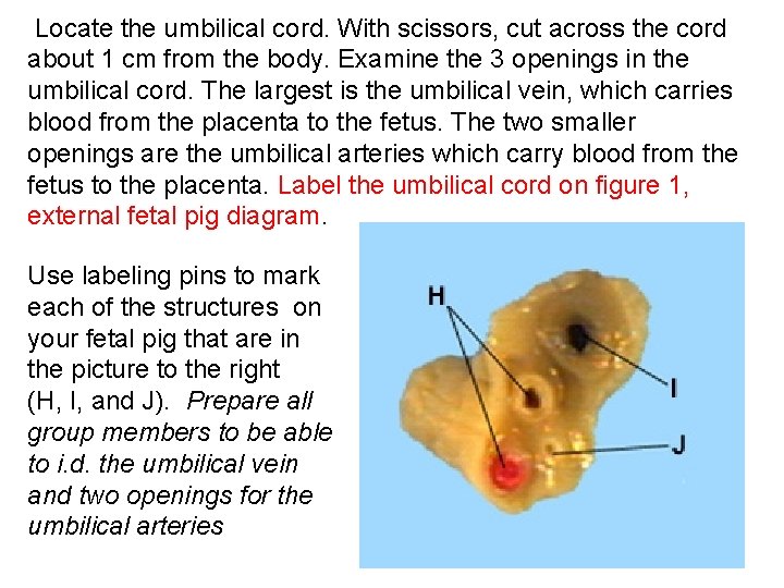 Locate the umbilical cord. With scissors, cut across the cord about 1 cm Locate the umbilical cord. With scissors, cut across the cord about 1 cm