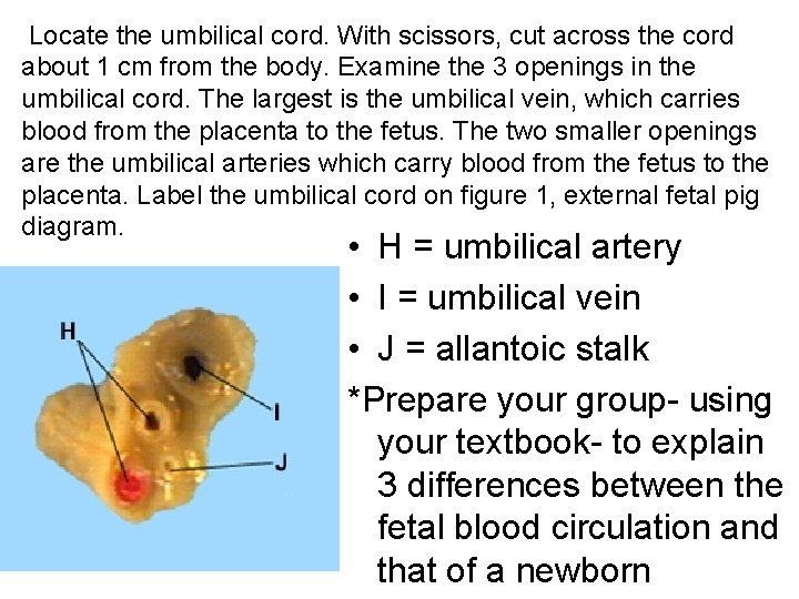  Locate the umbilical cord. With scissors, cut across the cord about 1 cm