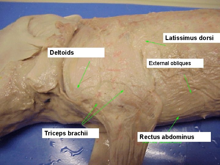 Latissimus dorsi Deltoids External obliques Triceps brachii Rectus abdominus 