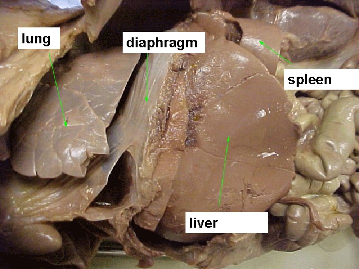 lung diaphragm spleen liver 