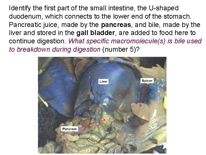 Identify the first part of the small intestine, the U-shaped duodenum, which connects to