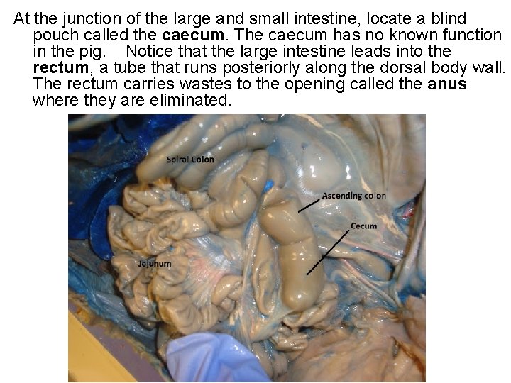 At the junction of the large and small intestine, locate a blind pouch called At the junction of the large and small intestine, locate a blind pouch called