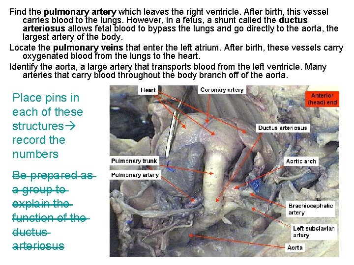 Find the pulmonary artery which leaves the right ventricle. After birth, this vessel carries