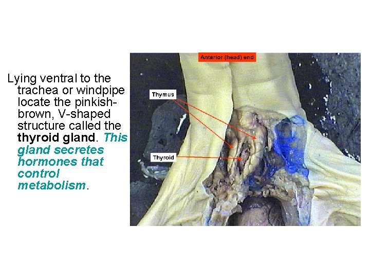 Lying ventral to the trachea or windpipe locate the pinkishbrown, V-shaped structure called Lying ventral to the trachea or windpipe locate the pinkishbrown, V-shaped structure called