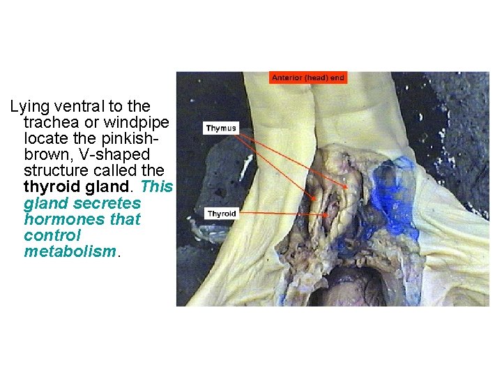  Lying ventral to the trachea or windpipe locate the pinkishbrown, V-shaped structure called