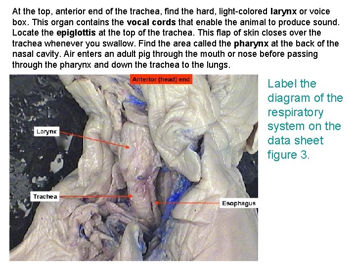 At the top, anterior end of the trachea, find the hard, light-colored larynx or