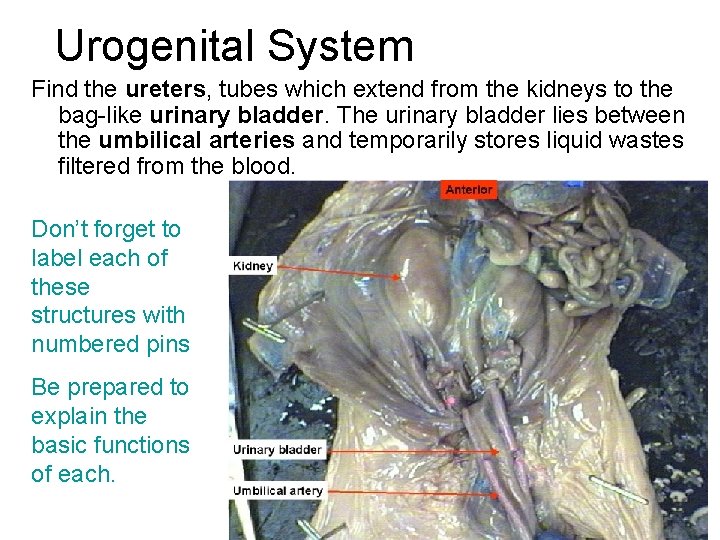 Urogenital System Find the ureters, tubes which extend from the kidneys to the bag-like